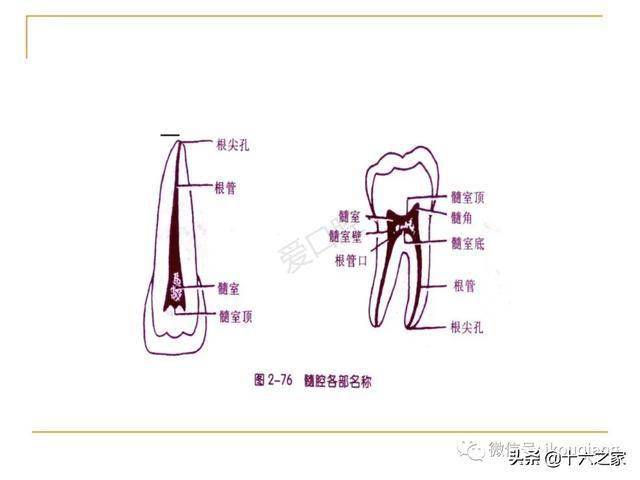 牙体髓腔解剖系统开髓,开髓洞型及根管常用器械的认识和使用