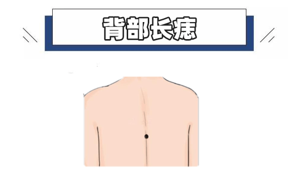 五颗"富贵"痣,颗颗带黄金,个个财大气粗,万里挑一的好