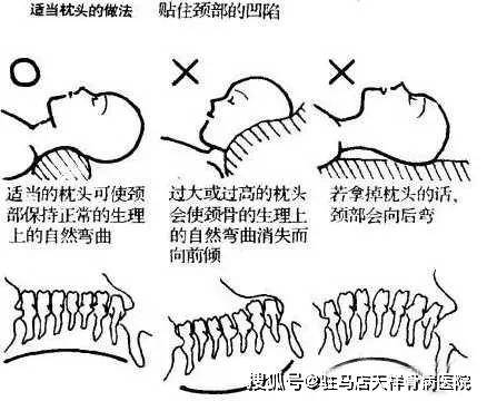 席梦思对于大多数人都为合适. 高枕与不用枕头对颈椎都不利.