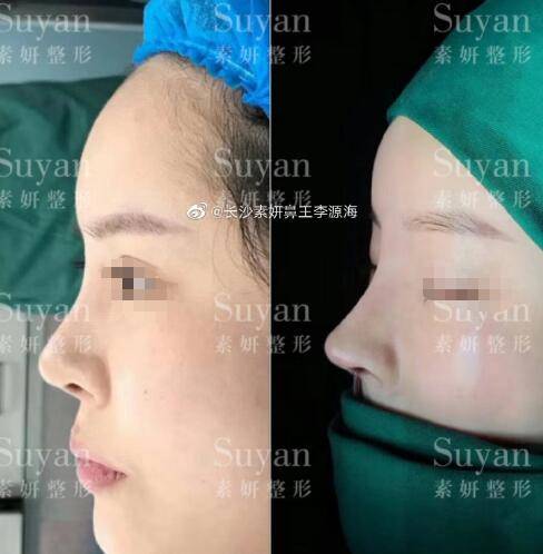 整形科排名_丰胸整形医院排名(3)