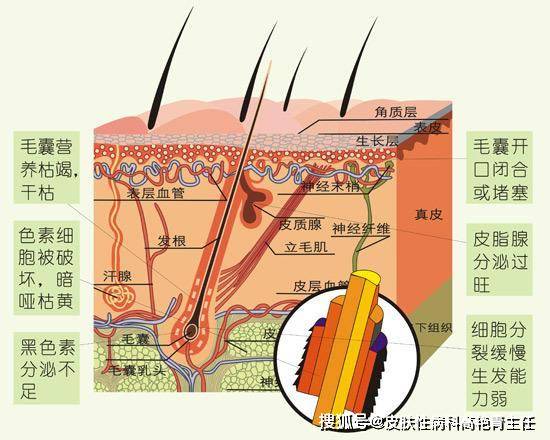 26岁掉头发严重怎么办