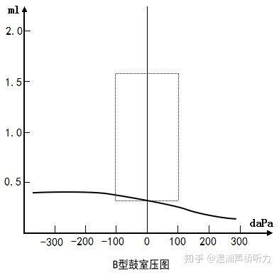 一分钟教你看懂鼓室图