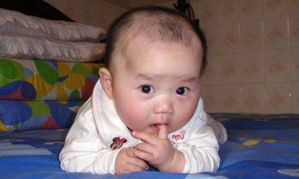 牙齿：你都知道吗？宝妈收藏!孩子在长牙期间的这些表现