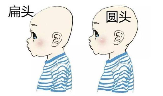 妈妈别给我睡扁头;老一辈的坚持,毁