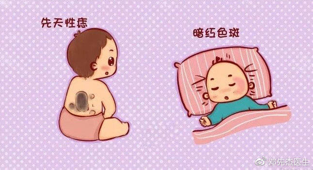 【孕妈须知】宝宝为什么会有胎记?孕期如何避免?