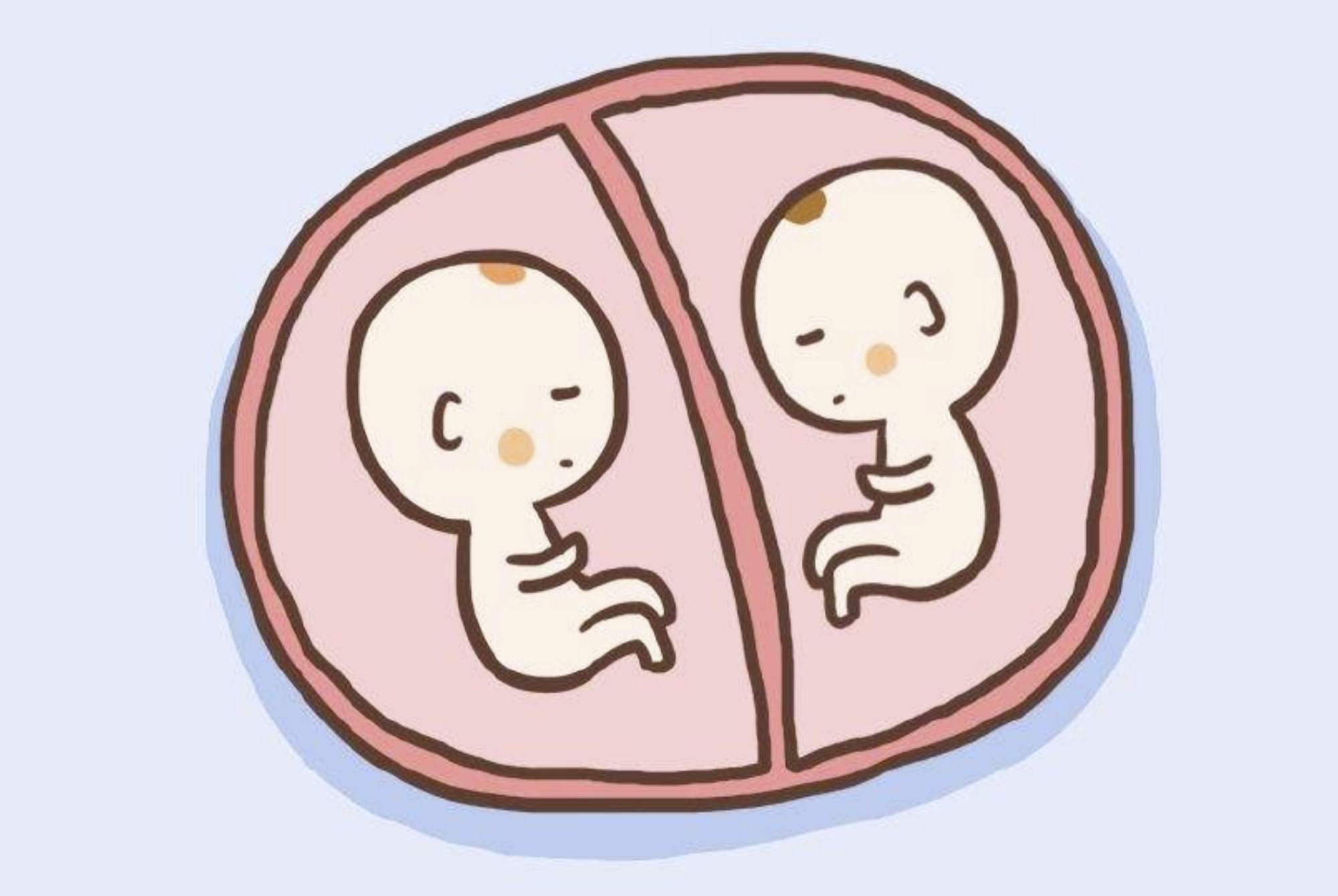 双胞胎因“基因偏心”走红，发量一个随爹一个随妈，差距惹人心疼