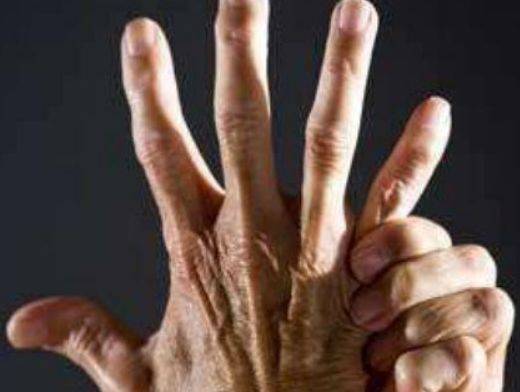 53岁男子,查出肺癌,再次提醒:手指出现3个异常,及时查
