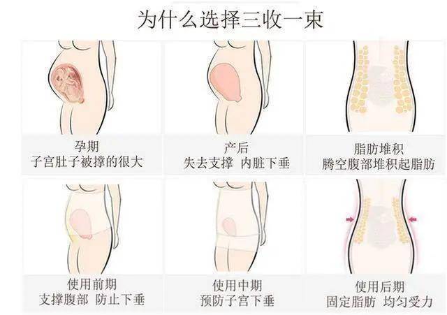 树袋宝宝教大家如何预防产后内脏下垂