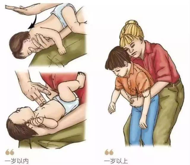 孩子|多亏父母的“两个果断”救了娃,医生都称赞3岁小孩被鱼刺卡喉