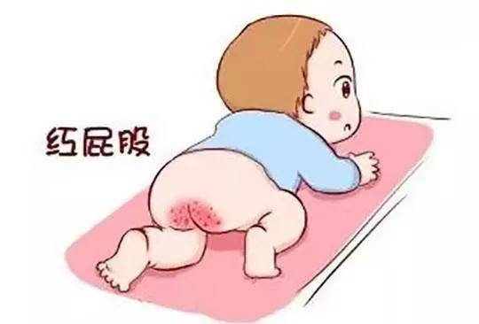 宝宝|优树育儿：尿布疹、湿疹傻傻分不清？宝宝湿疹如何搞定？