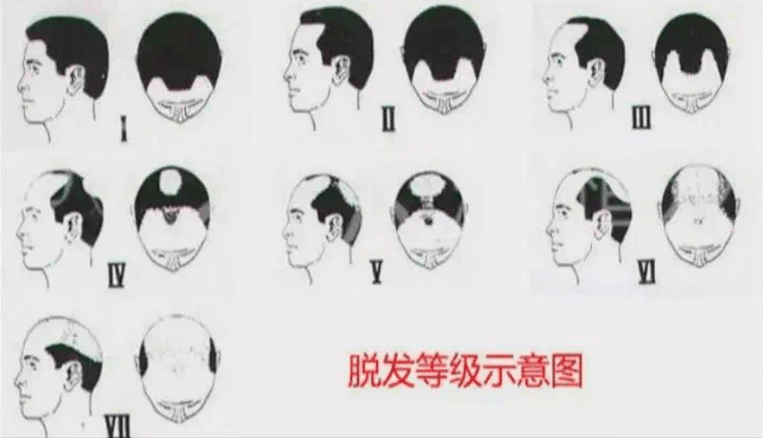 e86726646785401c91517b6f4b98d767.png