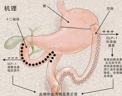 何谓流到人口_人口普查(2)