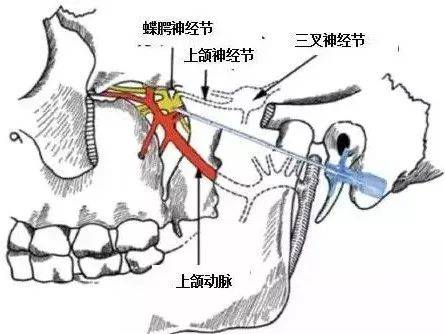 哭过以后头疼怎么办