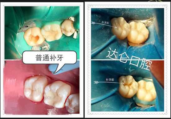 怎么正确养护牙齿 7182bd166ebe43beb237d5087673ffde.jpeg