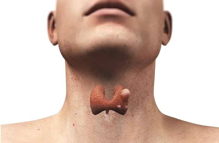 3个身体症状,其实是甲状腺癌"一级警报"!别以为是咽炎
