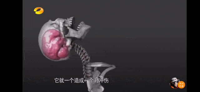 原创3岁女孩坐电动车被卷进卡车：莫让电瓶车成为孩子夺命车