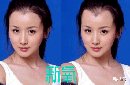 虞书欣不是才24岁吗?怎么就秃成这样了…