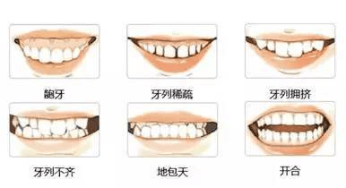 文章配图-2