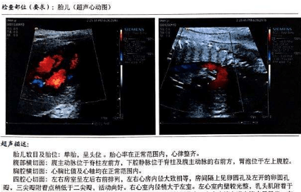 孕期不同阶段b超单信息,关乎胎儿健康,你都知道吗?