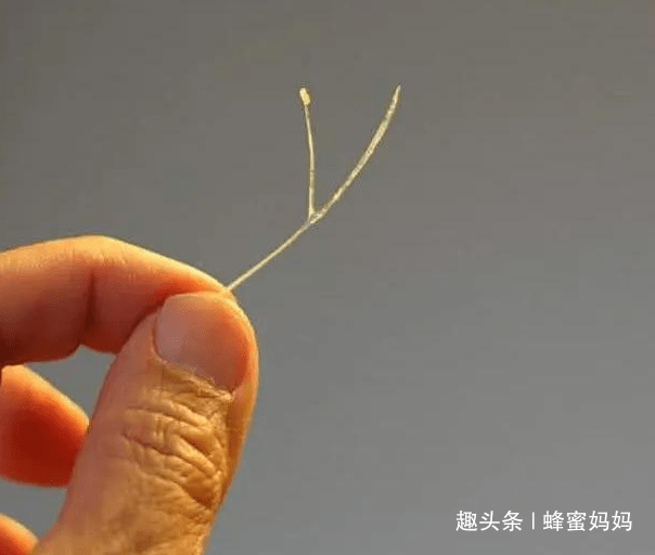 孩子|爸爸2个“果断”救了儿子，医生：家长该学4岁男孩被鱼刺卡喉