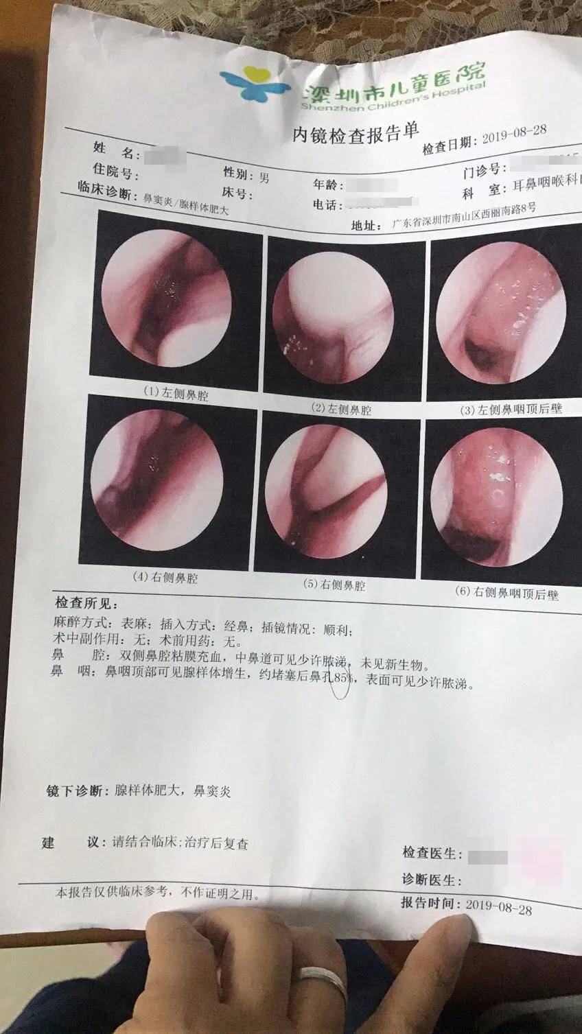 王丹丹医师小儿腺样体肥大鼻炎鼻窦炎打鼾