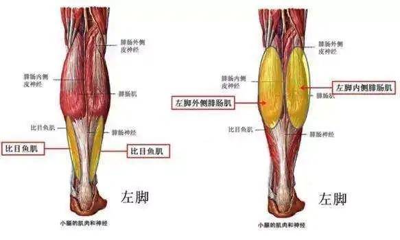 就容易粗腿造成腿粗的根本原因就是这两块肌肉发展不平均小腿肌肉由