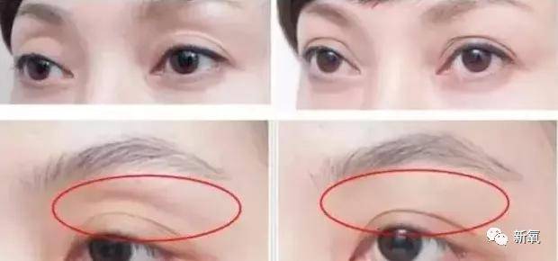 原创好歹也是娱乐圈第一代人造顶级美女,怎么也因为乱填充翻车了? 原创好歹也是娱乐圈第一代人造顶级美女,怎么也因为乱填充翻车了?