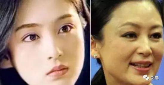 原创好歹也是娱乐圈第一代人造顶级美女,怎么也因为乱填充翻车了? 原创好歹也是娱乐圈第一代人造顶级美女,怎么也因为乱填充翻车了?