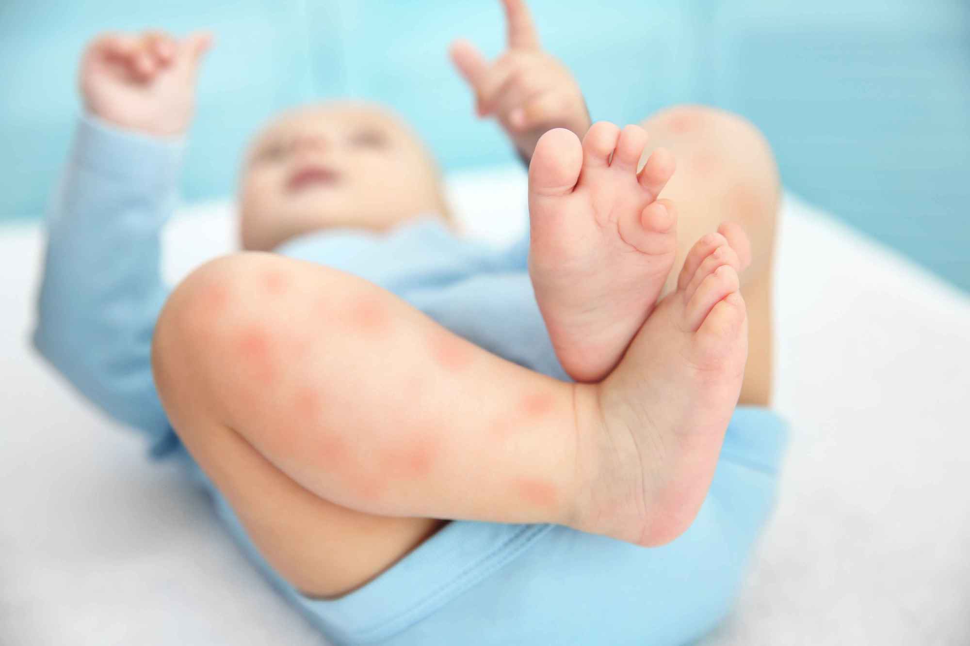 儿童营养性佝偻病，该如何预防？别等冒出这3个表现时才后悔