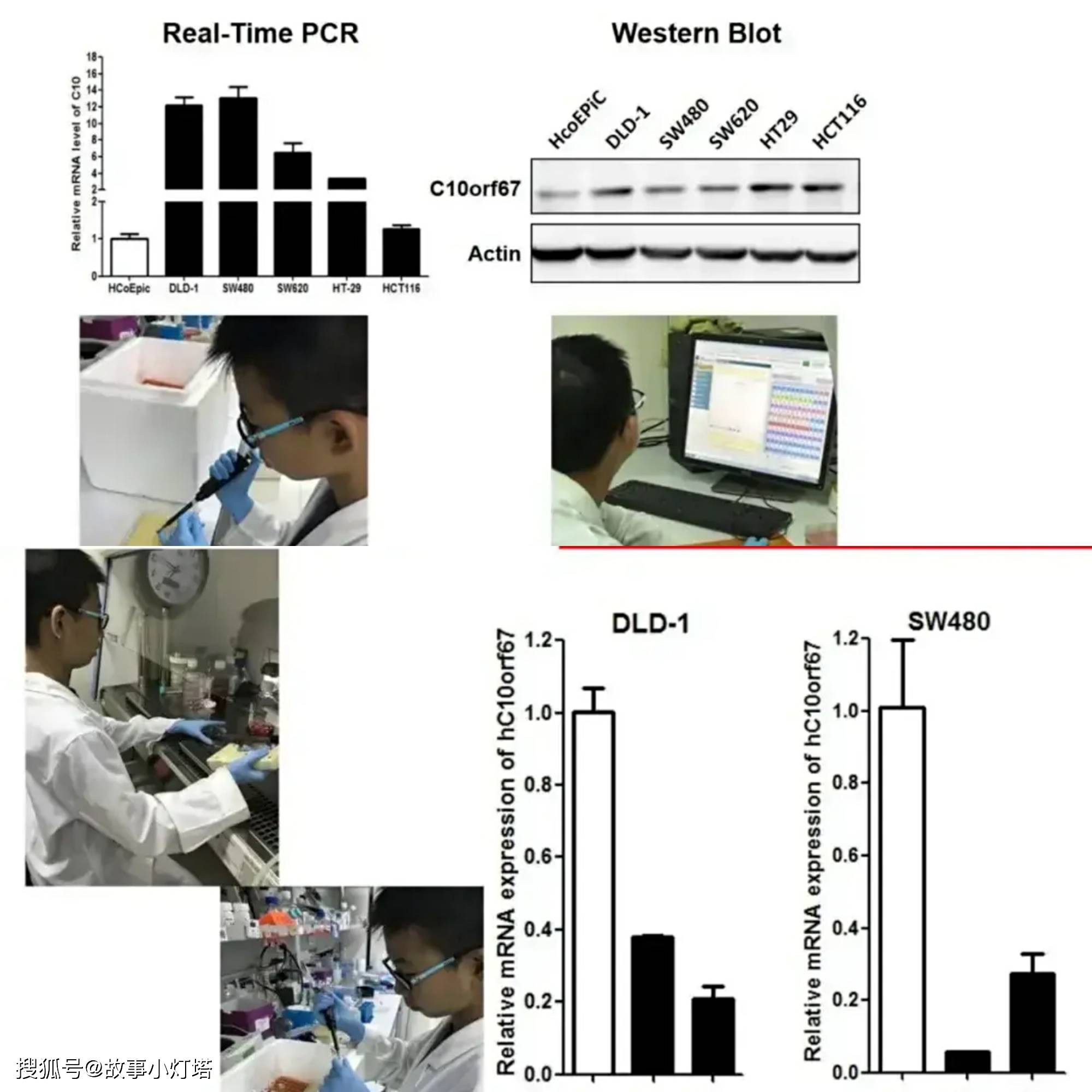 原创昆明一小学生研究结直肠癌获奖被疑造假!浅谈“灵石”转世的背后 原创昆明一小学生研究结直肠癌获奖被疑造假!浅谈“灵石”转世的背后