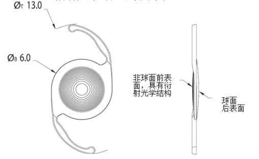 福建爱尔康三焦点人工晶体成功植入,大叔术后视力重返年轻态