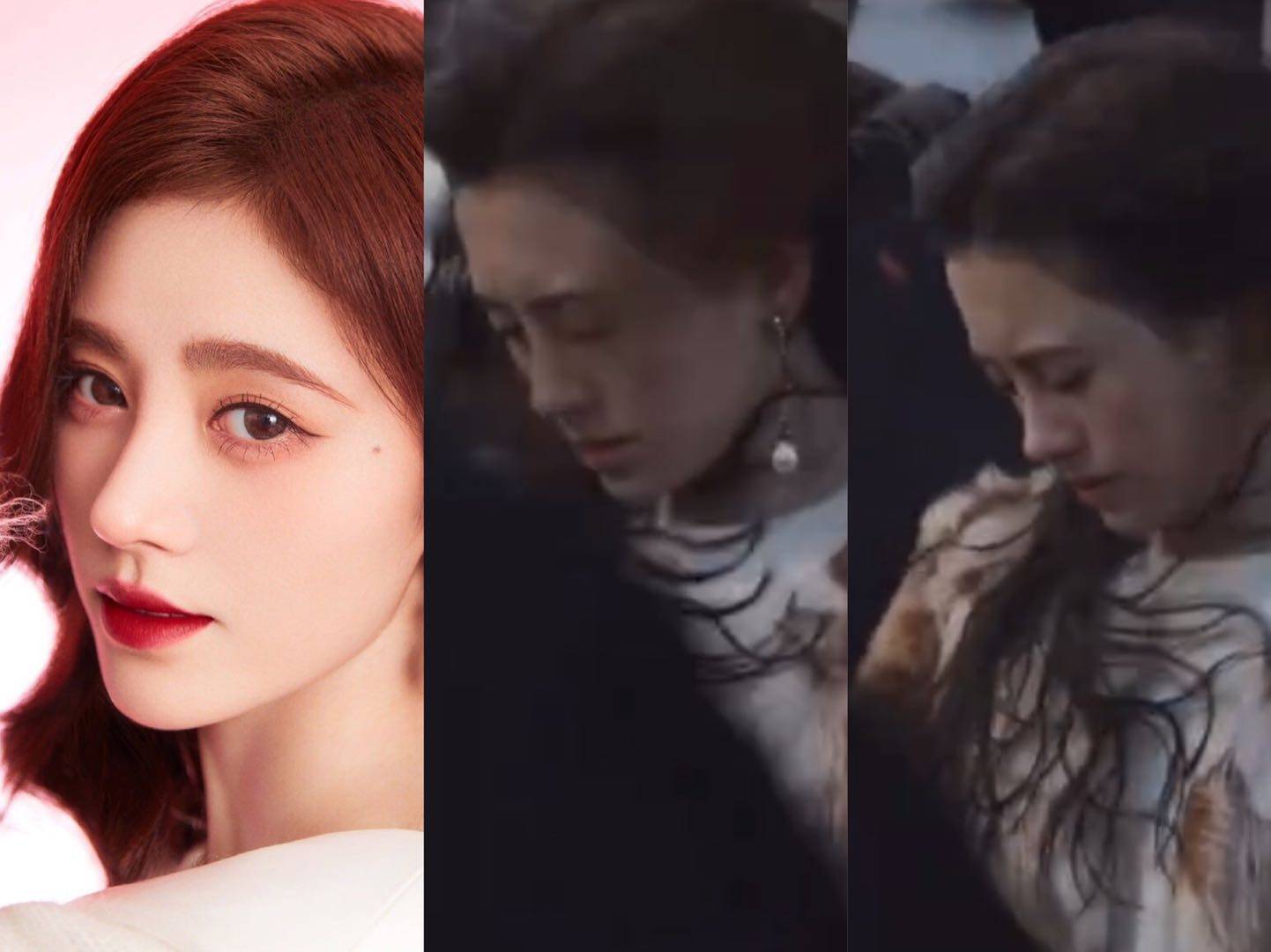 后移|鞠婧祎高发际线曝光,杨幂被质疑植发,她们二十多岁发际线堪忧