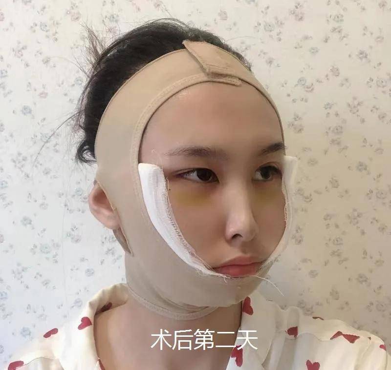 高圆圆|高圆圆整前生图曝光，惊到我了，do的一点不比baby少！