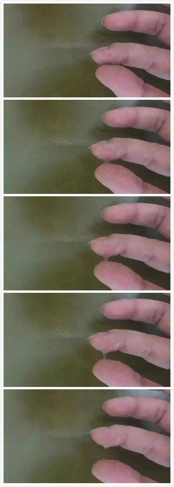 乔雅登|你与女神的小V脸，可能就是一个下巴的距离！