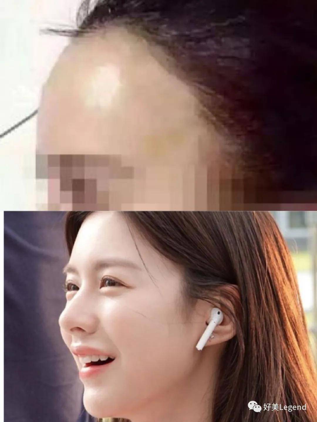 图片|如何整的自然好看?高级ins脸的关键因素有这几点!