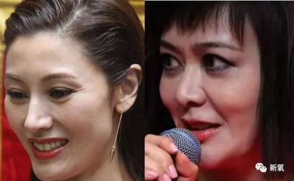 张脸|当年艳绝四方让张雨绮都甘心做配,可现在这张脸说崩就崩了...