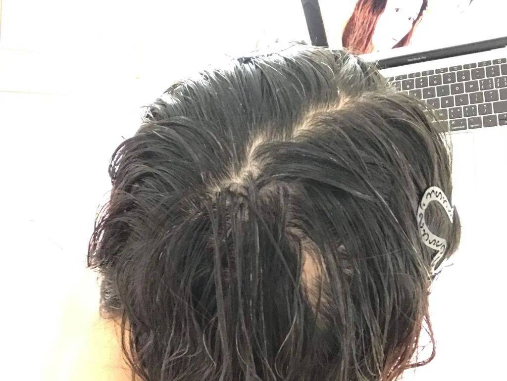 夏季头发油腻多扁塌,头发暴晒,你的头发正在面临挑战!