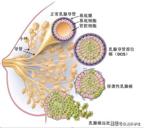 倪海厦:详述导致乳岩的七大原因