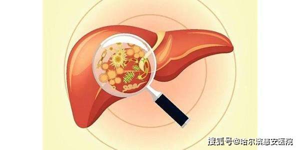 【肝炎】小便深黄,大便浅白,你可能得了淤胆型肝炎.