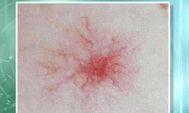 吃什么对肝功能有益 0f2e711e196949be9a501b3316915488.jpeg