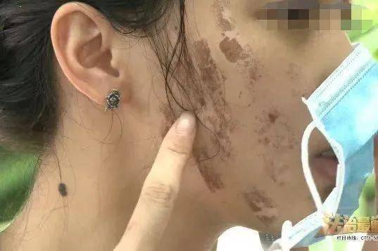 观点评论|靠流量做医美注定乱象丛生 美团恐陷入“发展陷阱”