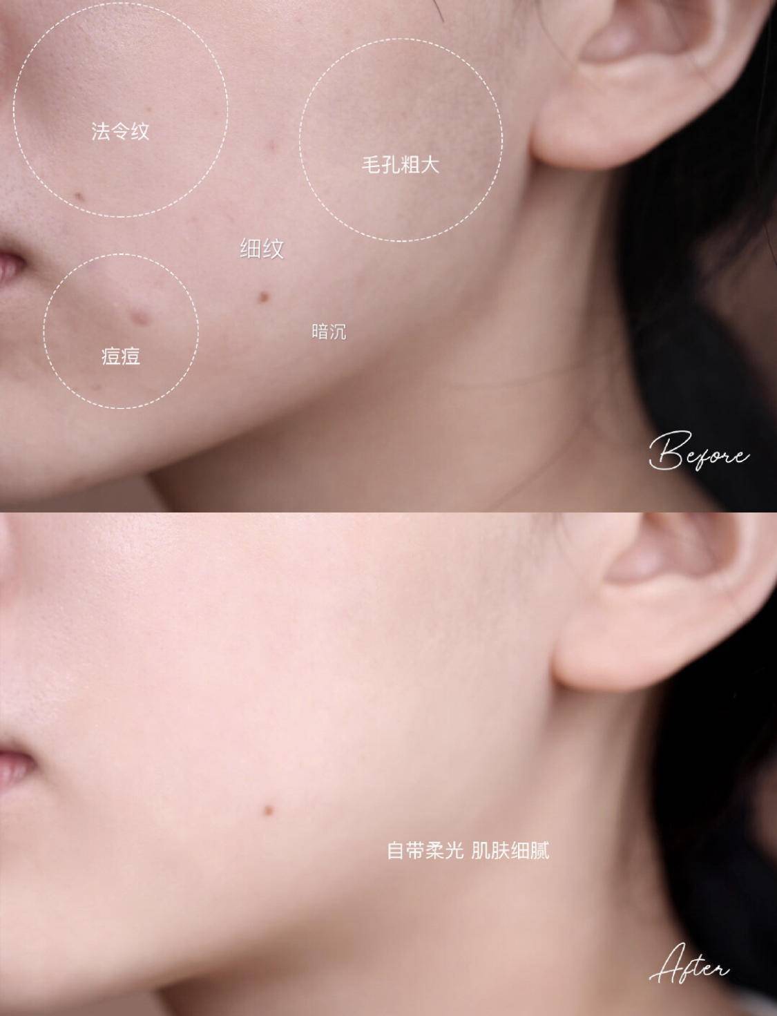 肌肤|不要被美白冲昏了头，夏季才是稳固年轻态的制胜关键