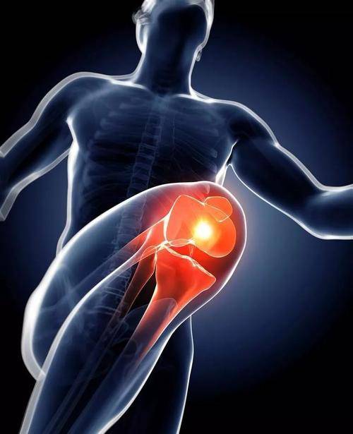 膝关节是人体的重要部位,需要给予特别的重视和保护.