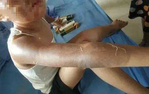 "|宁夏家长要警惕!孩子"头号杀手"竟是它!还有这个玩具事故频发,已上"黑名单"