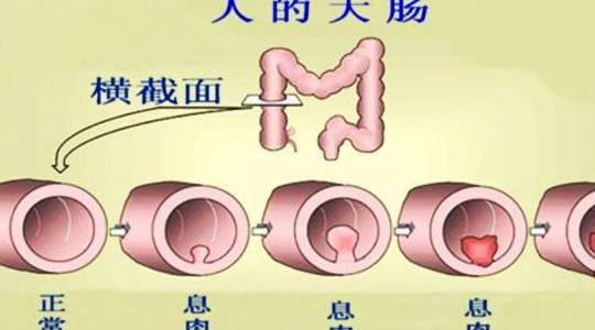 什么病需要做胃镜肠镜检查 6f27f8ea80d54d67939ec4964a96a6a0.jpeg