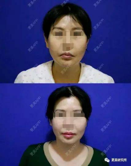 古天乐|蓝盈莹人品又陷争议，碰瓷港姐女神古天乐女友，营销真big胆