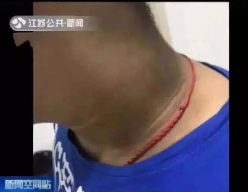 知识科普|“看不见的糖”正在伤害娃的身体！一图速查娃是否超重