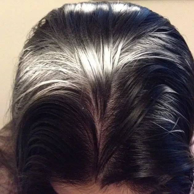 人间|叹头部SPA!拒做人间“油”物,解锁防秃养发小妙招!