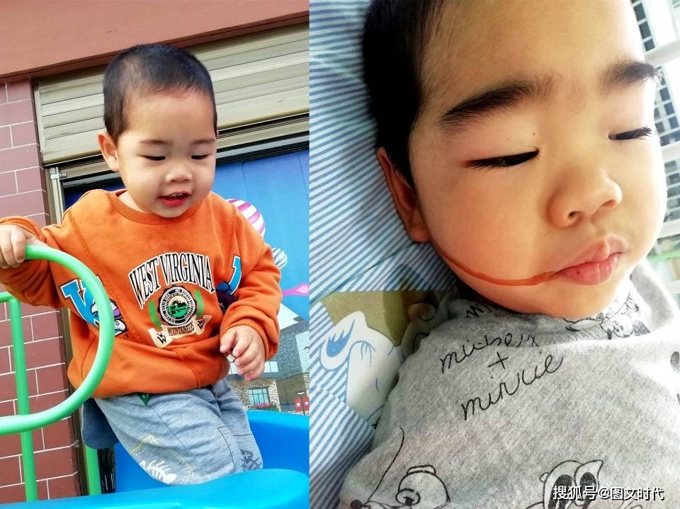 男童|病危通知下达12次，迷糊中哭喊：怕，妈妈抱2岁男童发烧120多天