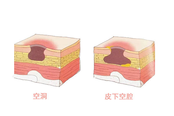 伤口结痂是黑色怎么办